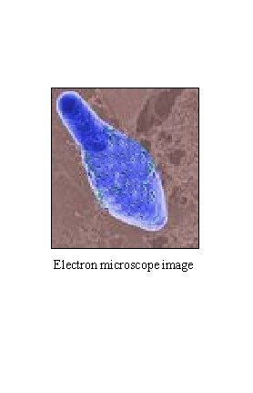 Electron microscope image 