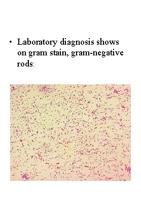  • Laboratory diagnosis shows on gram stain, gram-negative rods: 