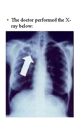  • The doctor performed the Xray below: 