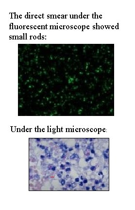 The direct smear under the fluorescent microscope showed small rods: Under the light microscope: