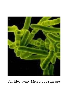 An Electronic Microscope Image 