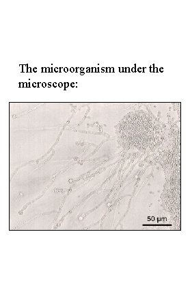 The microorganism under the microscope: 