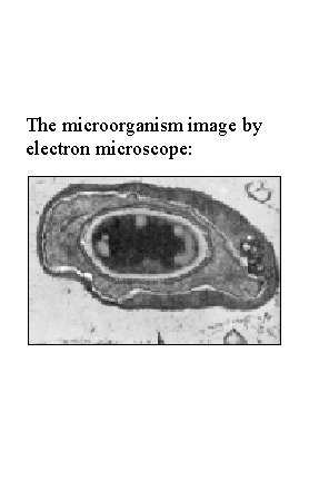 The microorganism image by electron microscope: 