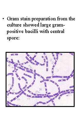  • Gram stain preparation from the culture showed large grampositive bacilli with central