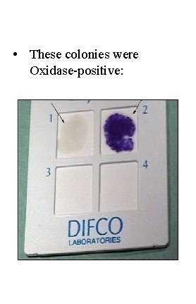  • These colonies were Oxidase-positive: 