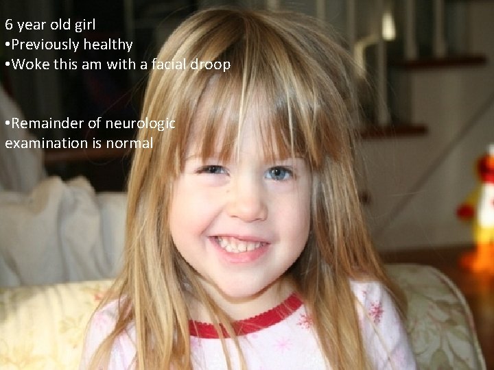 6 year old girl • Previously healthy • Woke this am with a facial 6 year old girl • Previously healthy • Woke this am with a facial