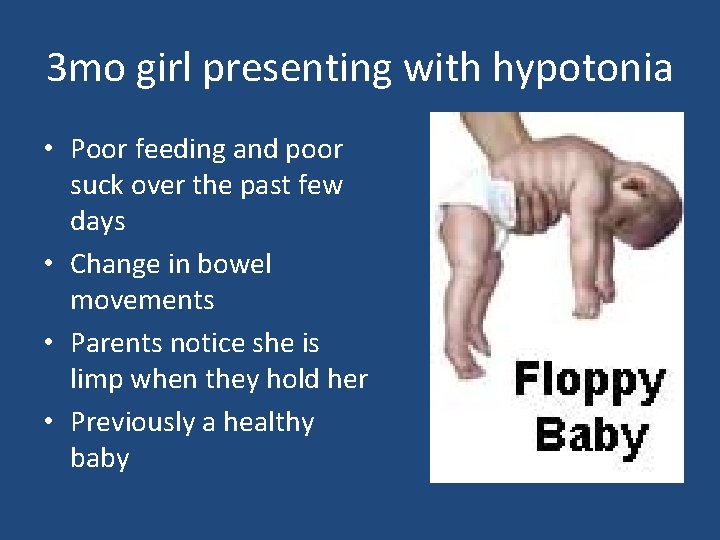 3 mo girl presenting with hypotonia • Poor feeding and poor suck over the 3 mo girl presenting with hypotonia • Poor feeding and poor suck over the