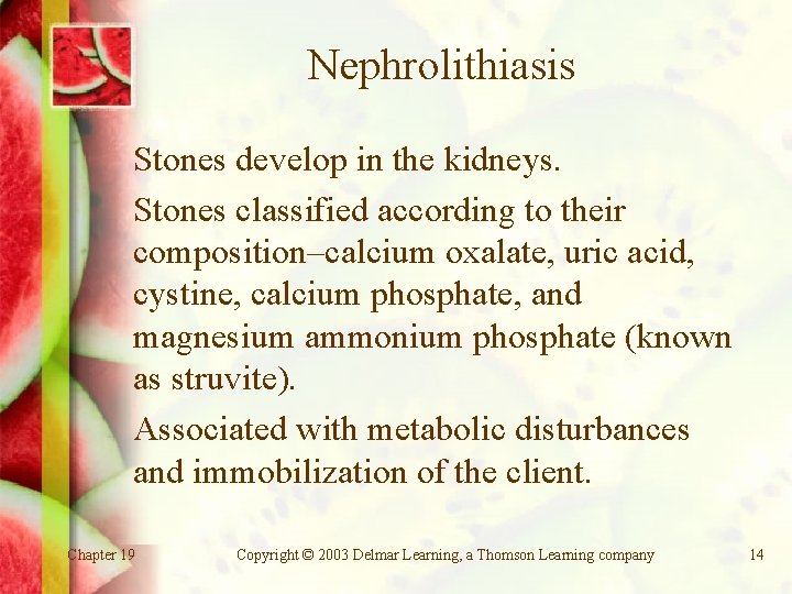 Nephrolithiasis Stones develop in the kidneys. Stones classified according to their composition–calcium oxalate, uric