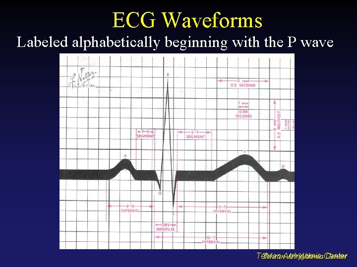 ECG Waveforms Labeled alphabetically beginning with the P wave Tehran. Arrhythmia. Center Tehran 