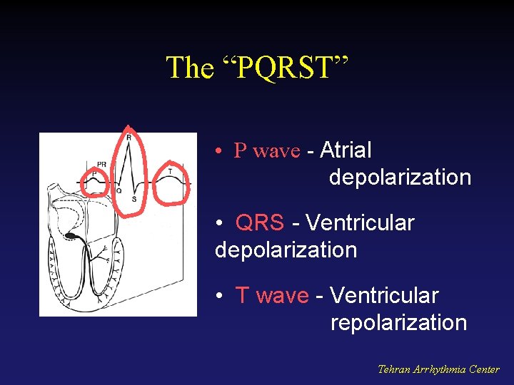The “PQRST” • P wave - Atrial depolarization • QRS - Ventricular depolarization •