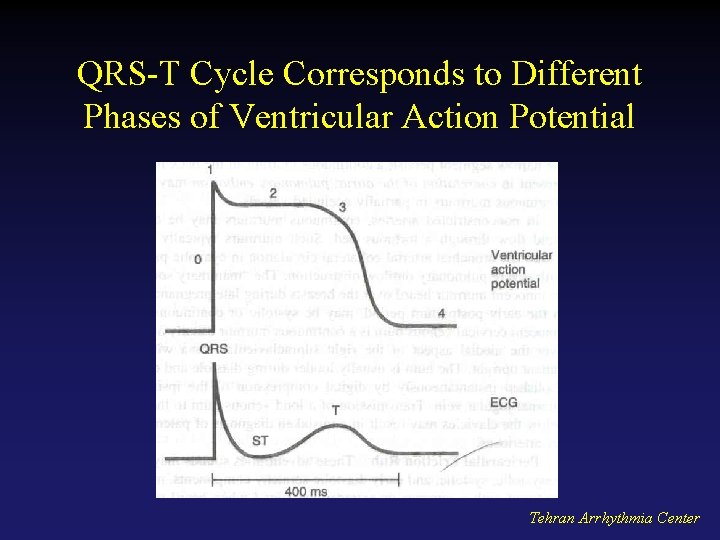 QRS-T Cycle Corresponds to Different Phases of Ventricular Action Potential Tehran Arrhythmia Center 