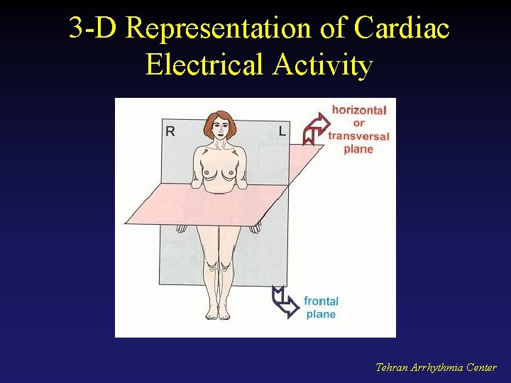 3 -D Representation of Cardiac Electrical Activity Tehran Arrhythmia Center 