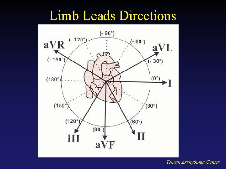 Limb Leads Directions Tehran Arrhythmia Center 
