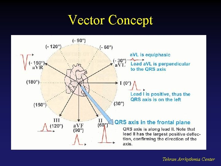 Vector Concept Tehran Arrhythmia Center 