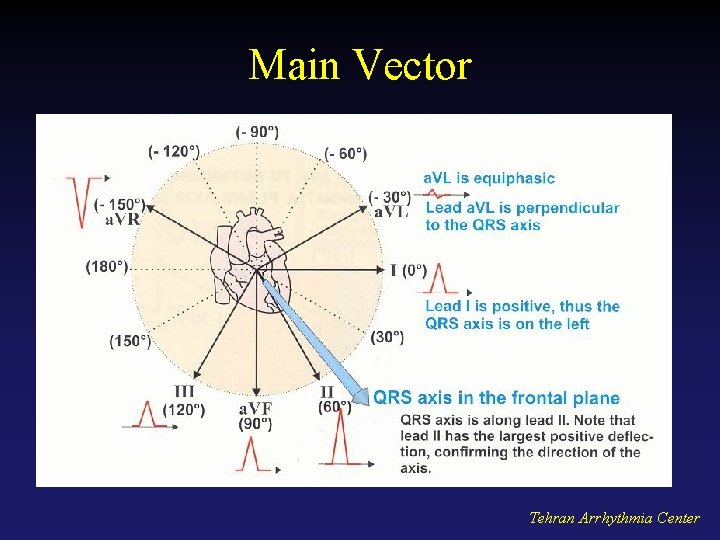 Main Vector Tehran Arrhythmia Center 