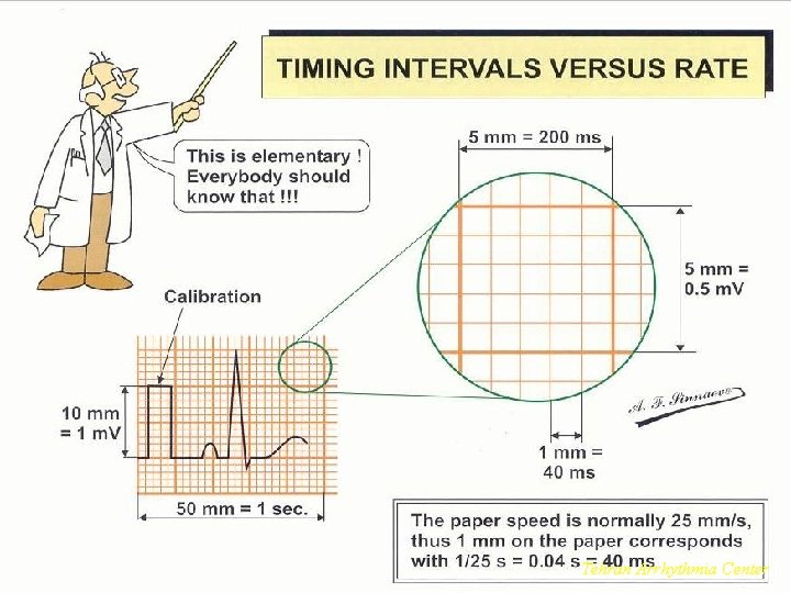 Timing Intervals Tehran Arrhythmia Center 
