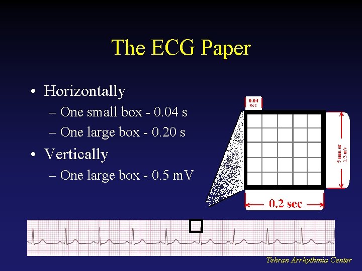 The ECG Paper • Horizontally – One small box - 0. 04 s –