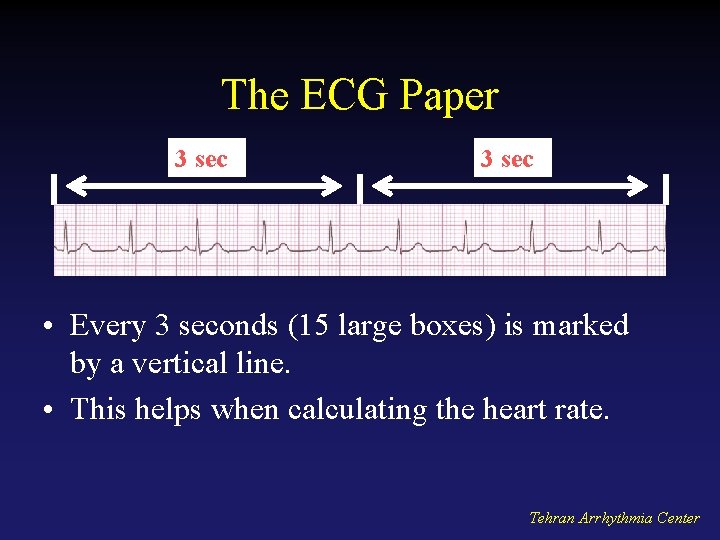 The ECG Paper 3 sec • Every 3 seconds (15 large boxes) is marked