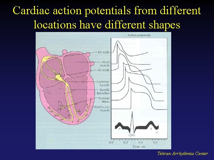 Cardiac action potentials from different locations have different shapes Tehran Arrhythmia Center 
