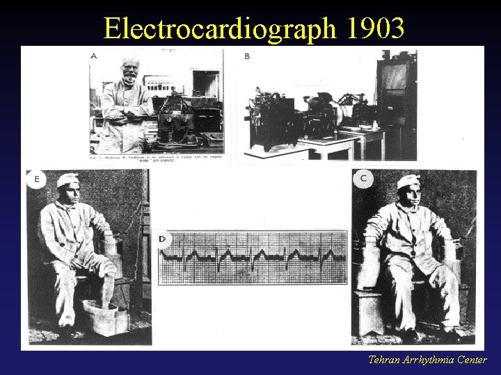 Electrocardiograph 1903 Tehran Arrhythmia Center 