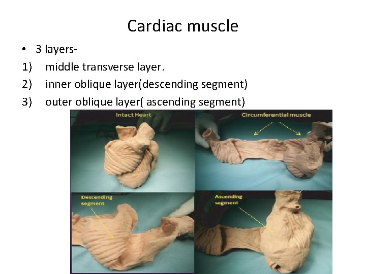 Cardiac muscle • 3 layers 1) middle transverse layer. 2) inner oblique layer(descending segment)