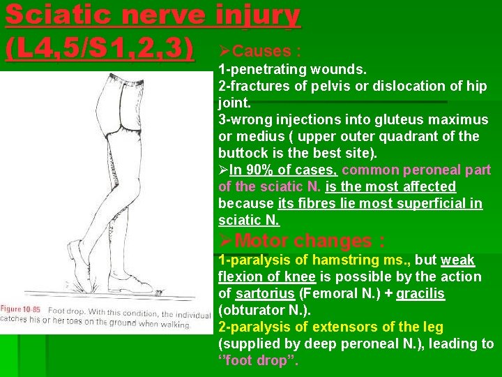 Sciatic nerve injury (L 4, 5/S 1, 2, 3) ØCauses : 1 -penetrating wounds. Sciatic nerve injury (L 4, 5/S 1, 2, 3) ØCauses : 1 -penetrating wounds.
