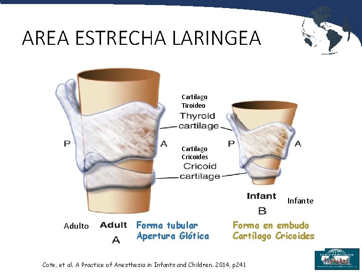 AREA ESTRECHA LARINGEA Cartílago Tiroideo Cartílago Cricoides Infante Adulto Forma tubular Apertura Glótica Forma