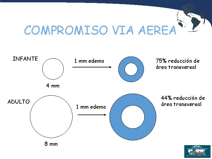 COMPROMISO VIA AEREA INFANTE 1 mm edema 75% reducción de área transversal 4 mm