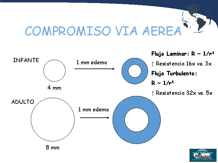 COMPROMISO VIA AEREA Flujo Laminar: R ~ 1/r 4 INFANTE 1 mm edema ↑