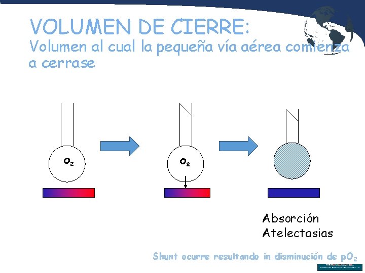 VOLUMEN DE CIERRE: Volumen al cual la pequeña vía aérea comienza a cerrase O