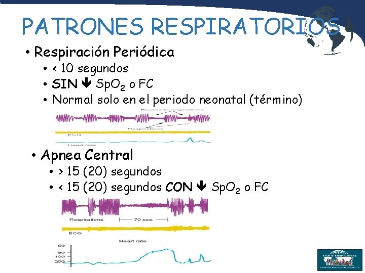 PATRONES RESPIRATORIOS • Respiración Periódica • < 10 segundos • SIN Sp. O 2