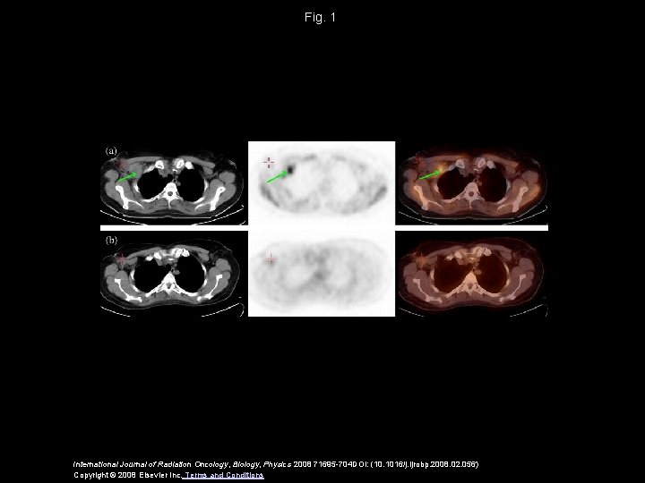 Fig. 1 International Journal of Radiation Oncology, Biology, Physics 2008 71695 -704 DOI: (10.