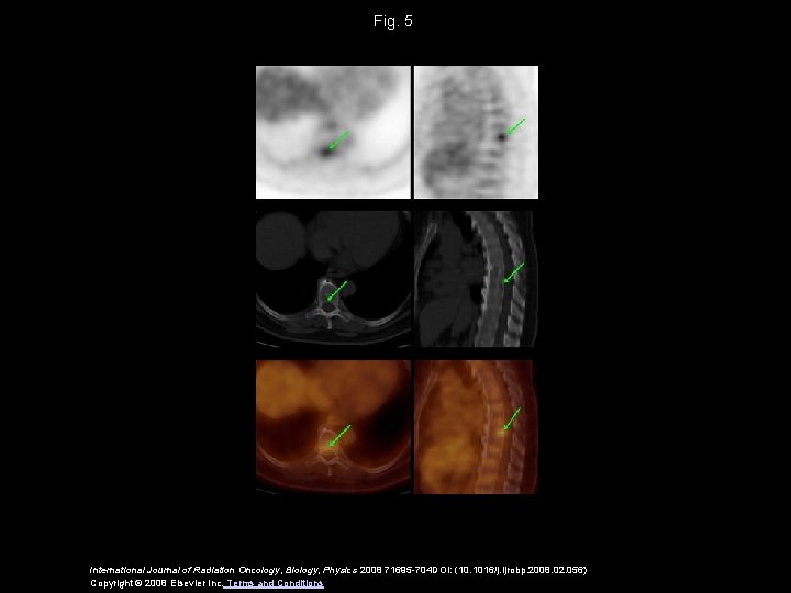 Fig. 5 International Journal of Radiation Oncology, Biology, Physics 2008 71695 -704 DOI: (10.