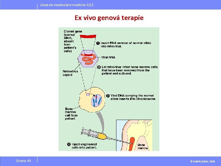 Úvod do molekulární medicíny 8/12 Ex vivo genová terapie Strana 44 © Ondřej Slabý,