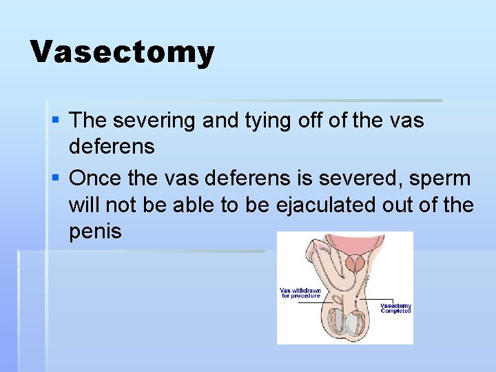 Vasectomy § The severing and tying off of the vas deferens § Once the