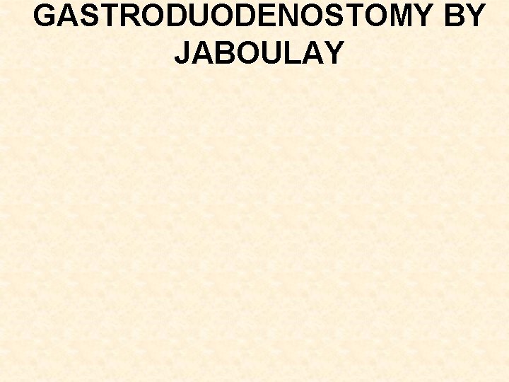 GASTRODUODENOSTOMY BY JABOULAY 
