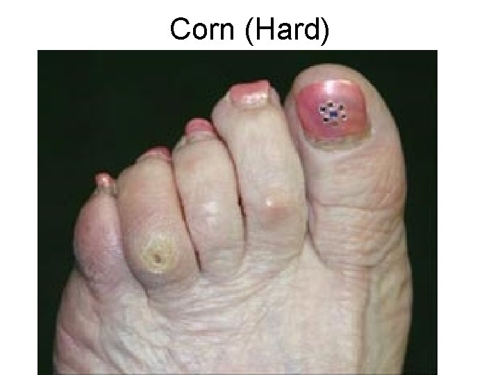 Corn (Hard) 