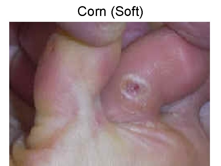 Corn (Soft) 