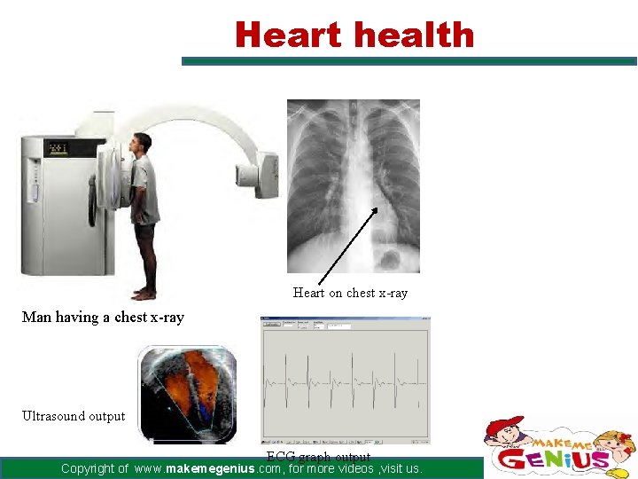 Heart health Heart on chest x-ray Man having a chest x-ray Ultrasound output ECG