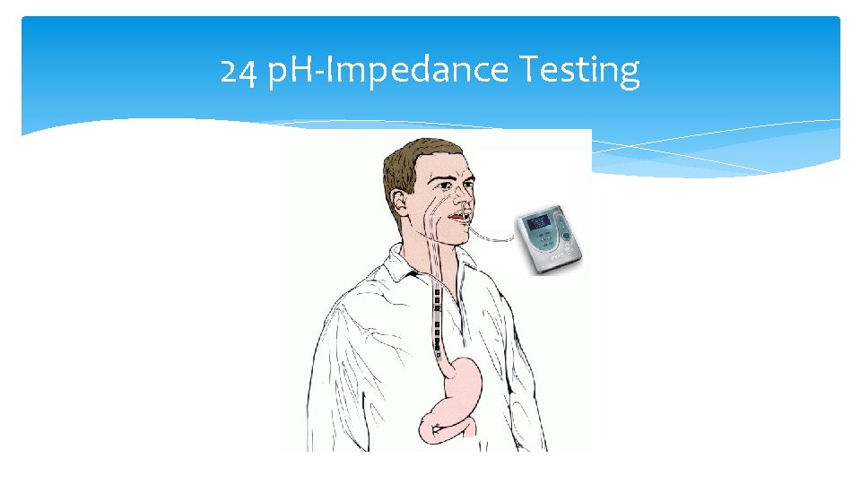 24 p. H-Impedance Testing 