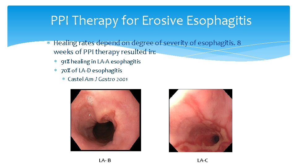 PPI Therapy for Erosive Esophagitis Healing rates depend on degree of severity of esophagitis.