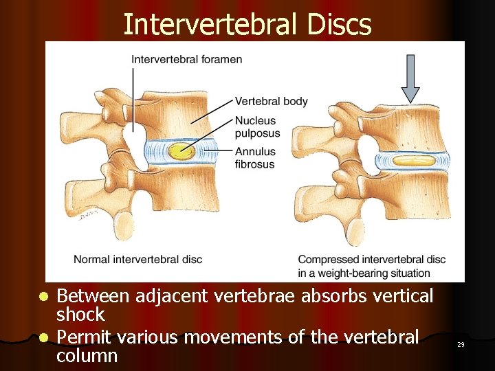 Intervertebral Discs Between adjacent vertebrae absorbs vertical shock l Permit various movements of the