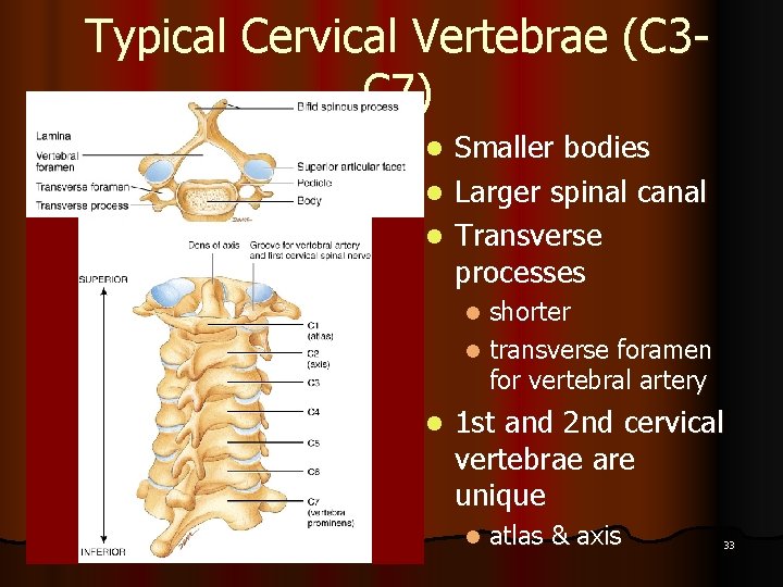 Typical Cervical Vertebrae (C 3 C 7) Smaller bodies l Larger spinal canal l