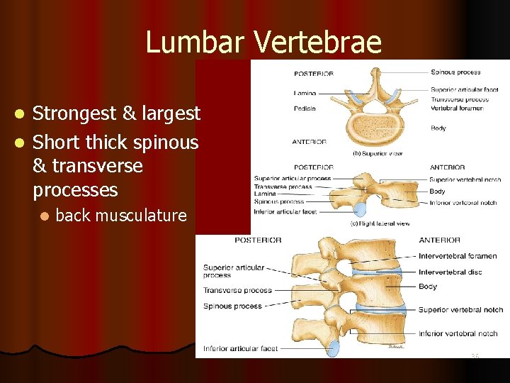 Lumbar Vertebrae Strongest & largest l Short thick spinous & transverse processes l l