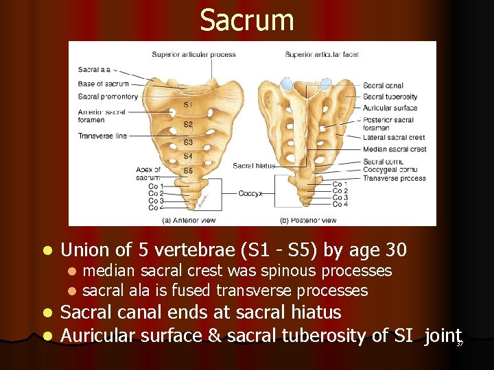 Sacrum l Union of 5 vertebrae (S 1 - S 5) by age 30