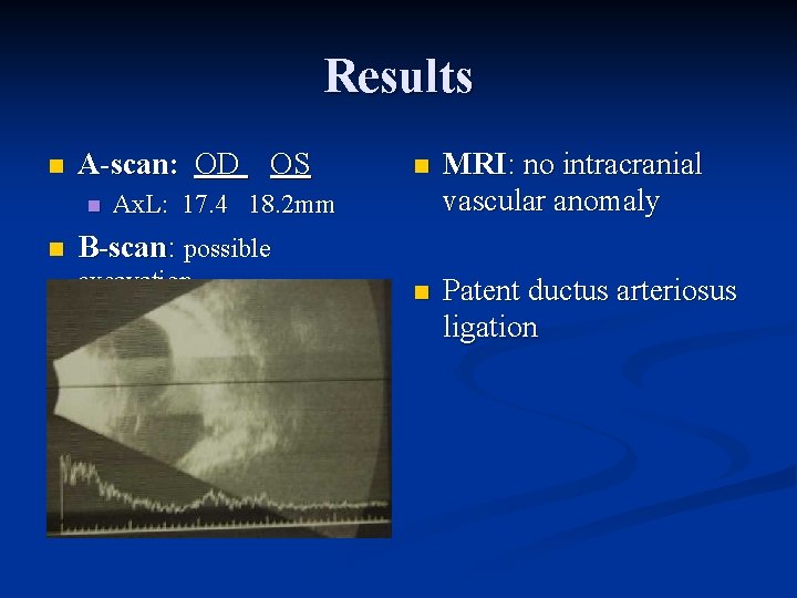 Results n A-scan: OD OS n n n MRI: no intracranial vascular anomaly n