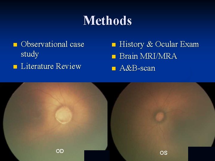 Methods n n Observational case study Literature Review OD OD n n n History