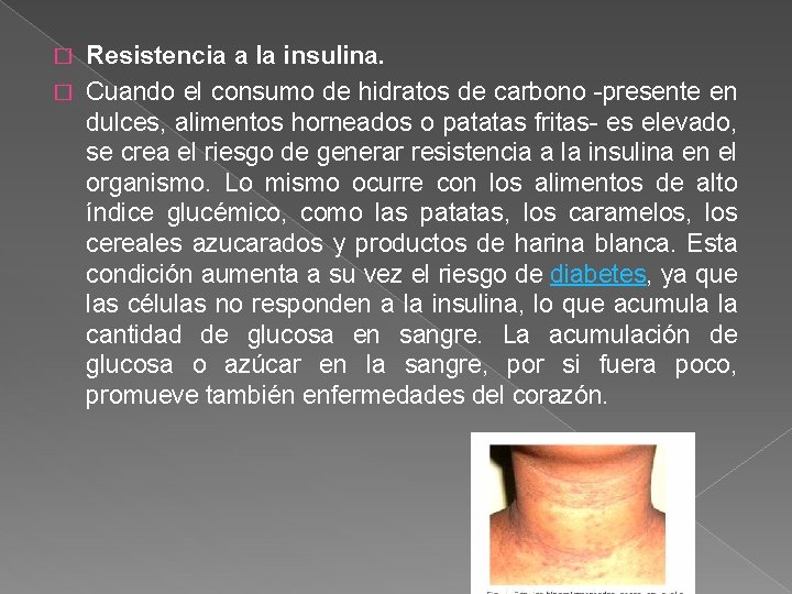 Resistencia a la insulina. � Cuando el consumo de hidratos de carbono -presente en Resistencia a la insulina. � Cuando el consumo de hidratos de carbono -presente en