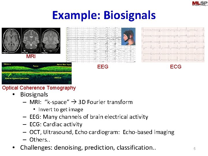 Example: Biosignals MRI EEG ECG Optical Coherence Tomography • Biosignals – MRI: “k-space” 3