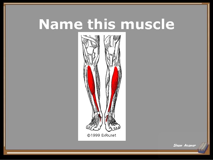 Name this muscle Show Answer 